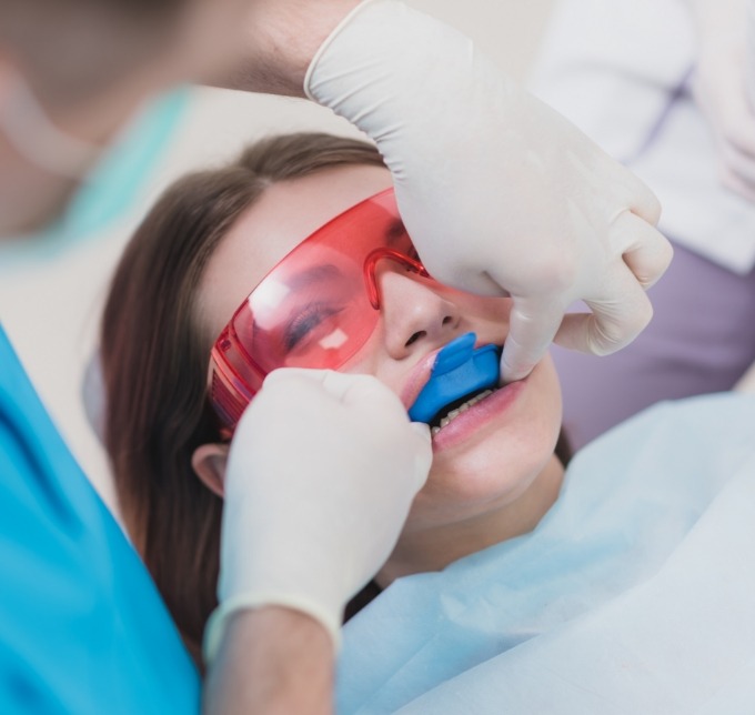 Female dental patient receiving a fluoride treatment