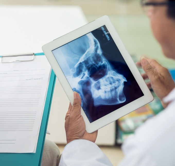 Dentist looking at at x ray of jaw on tablet