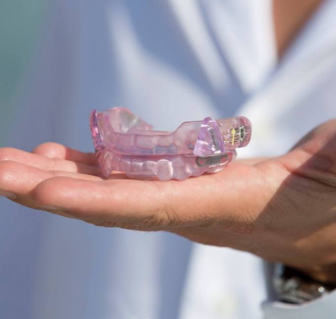 Hand holding an occlusal splint for TMJ treatment in Albuquerque